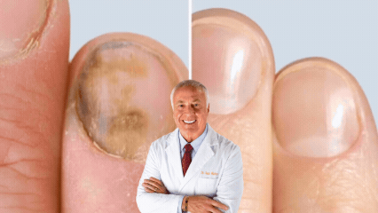 Toenail fungus treatment — how the protocol reaches the root infection